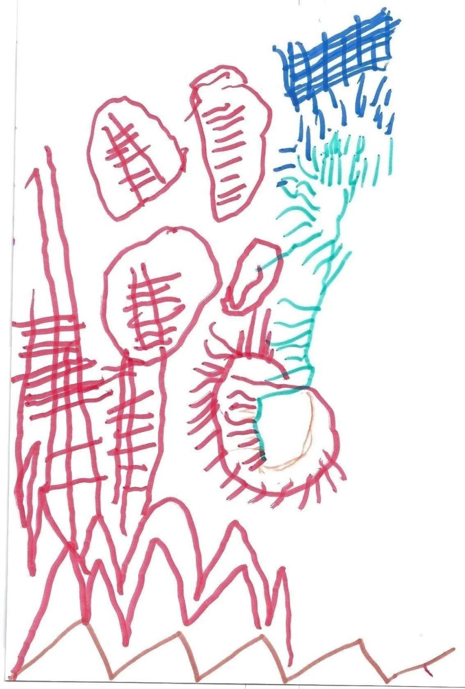 生命力的再创:中风复健艺术的探索与创新-20136